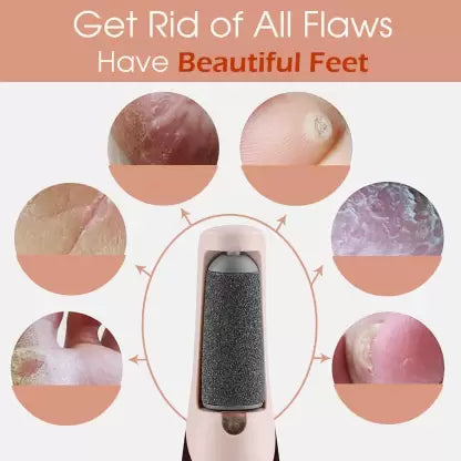 HeelEase Instant & Painless Feet Care Wand (Rechargeable & Wireless)